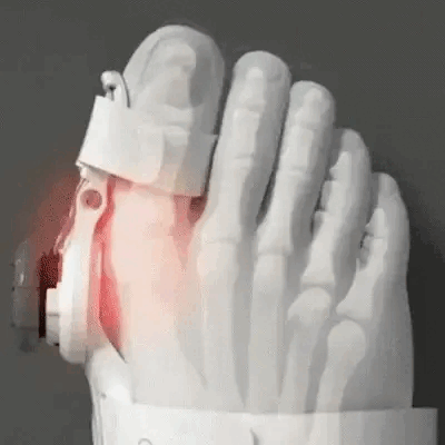 Démonstration correcteur hallux valgus utilisation facile ajustable